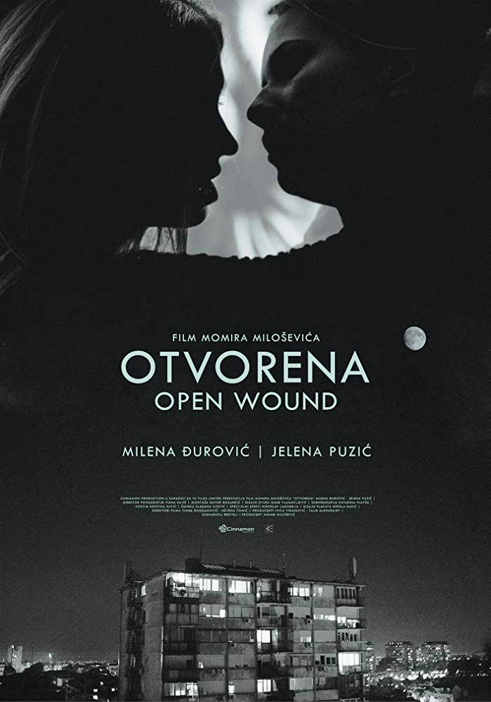 OTVORENA 